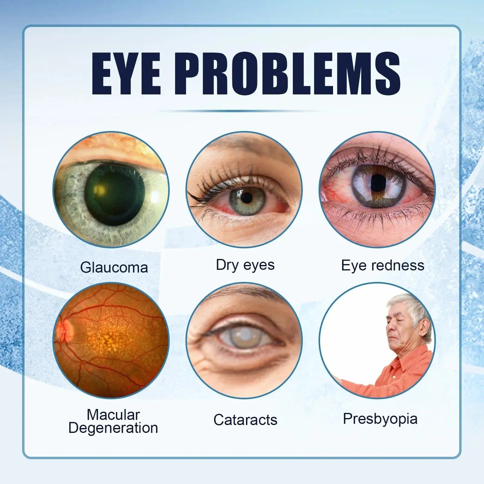 Eye Drops for Glacoma Presbyopia Dry Red Eyes Visual Fatigue Improving Eyesight Better Vision Whitening Lenses Eyes Care Liquid
