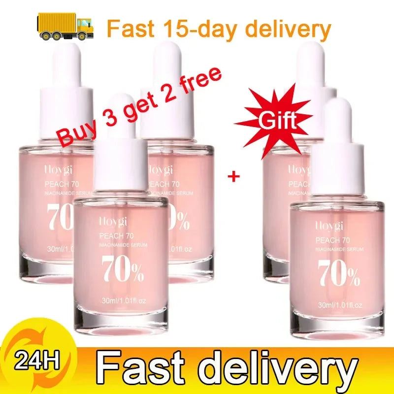 Niacinamide Dark Spots Remover Serum Face Freckle Melanin Correcting Essence Anti Pigmentation Whitening Brighten Dull Skin Care