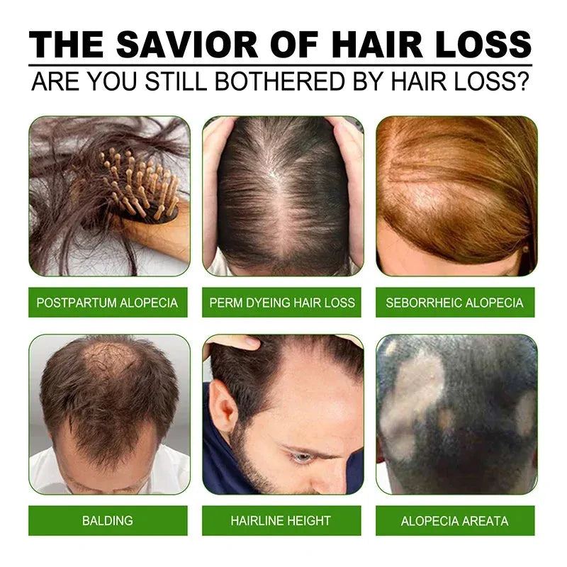 Fast Hair Growth Essence Hair Regeneration Essence Hair Follicle Care Anti-Hair Loss Essence Hair Thin Treatment Hair Care