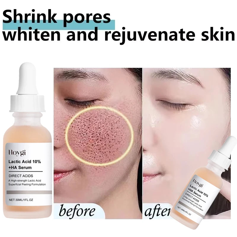 Lactic Acid Large Pores Removal Serum Fast Pore Shrinking Minimizing Essence Moisturizing Firming Smooth Repair Korean Skin Care