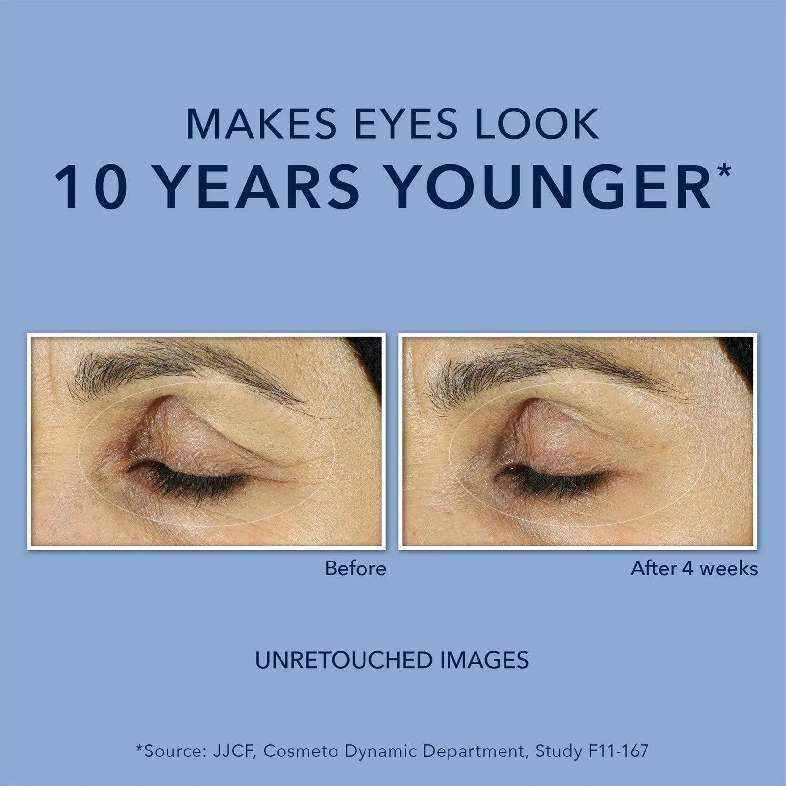 Roc Retinol Anti-Wrinkle + Firming Eye Paste For Dark Circles & Puffy Eyes Retinol Anti-Wrinkle Firming Eye Cream