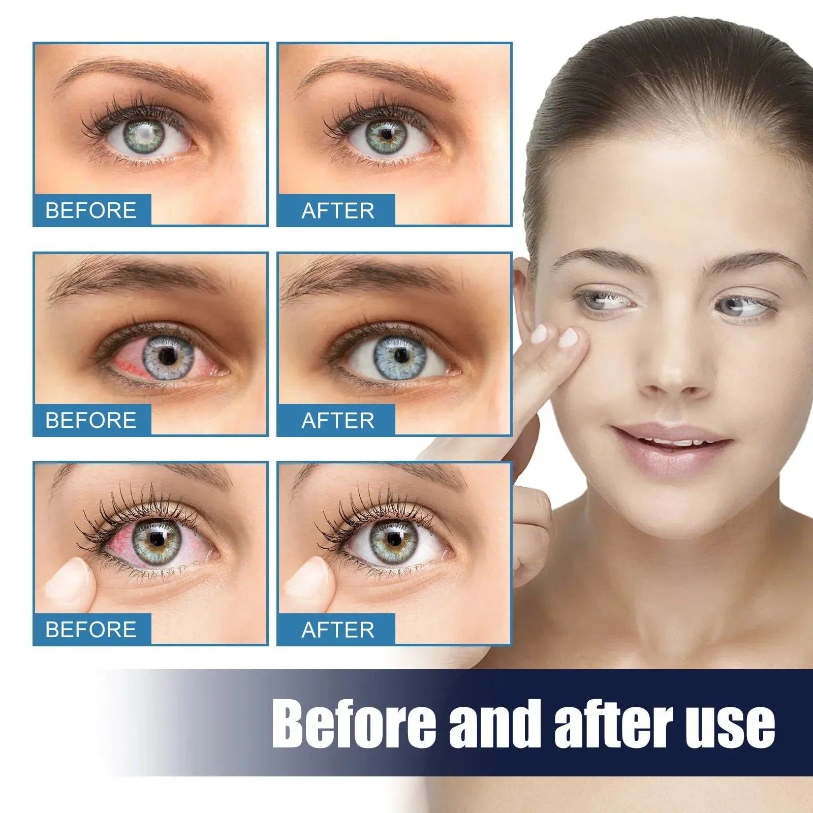Eye Drops for Glacoma Presbyopia Dry Red Eyes Visual Fatigue Improving Eyesight Better Vision Whitening Lenses Eyes Care Liquid