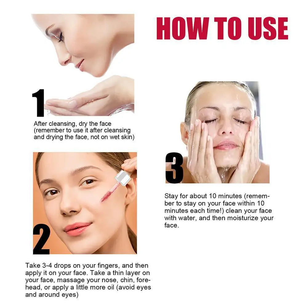 Salicylic Acid Serum Pores Shrinking Essence 30%AHA Product Treatment Moisturizing,exfoliate,Whitening,2%BHA Acne Face Care E6X6