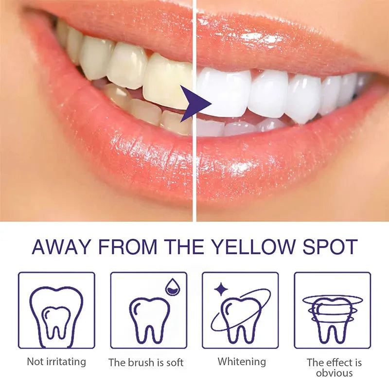 Tooth Whitening Enzyme Purple Mousse Remove Plaque Cleaning Oral Hygiene Dental Bleaching Tools Fresh Breath Beauty Tooth Care