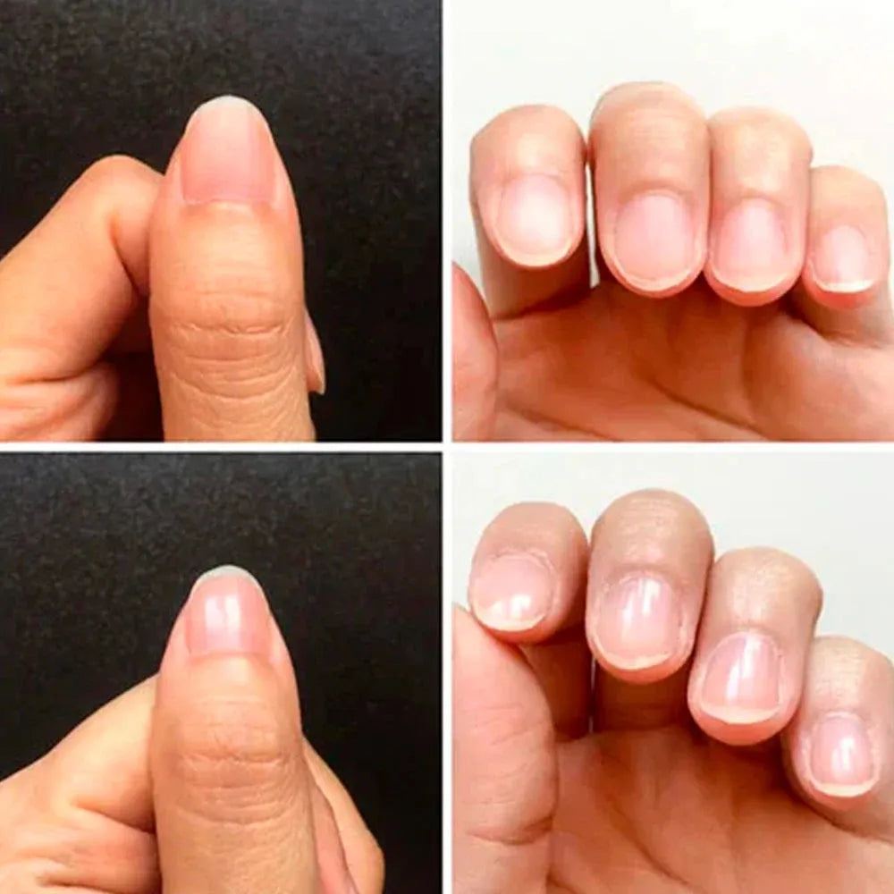 KODIES GEL 3 Day Nail Growth Maximal Nail Strengthener Treatment Hardener Keratin Healthy Normal Base Top Coat Repair System