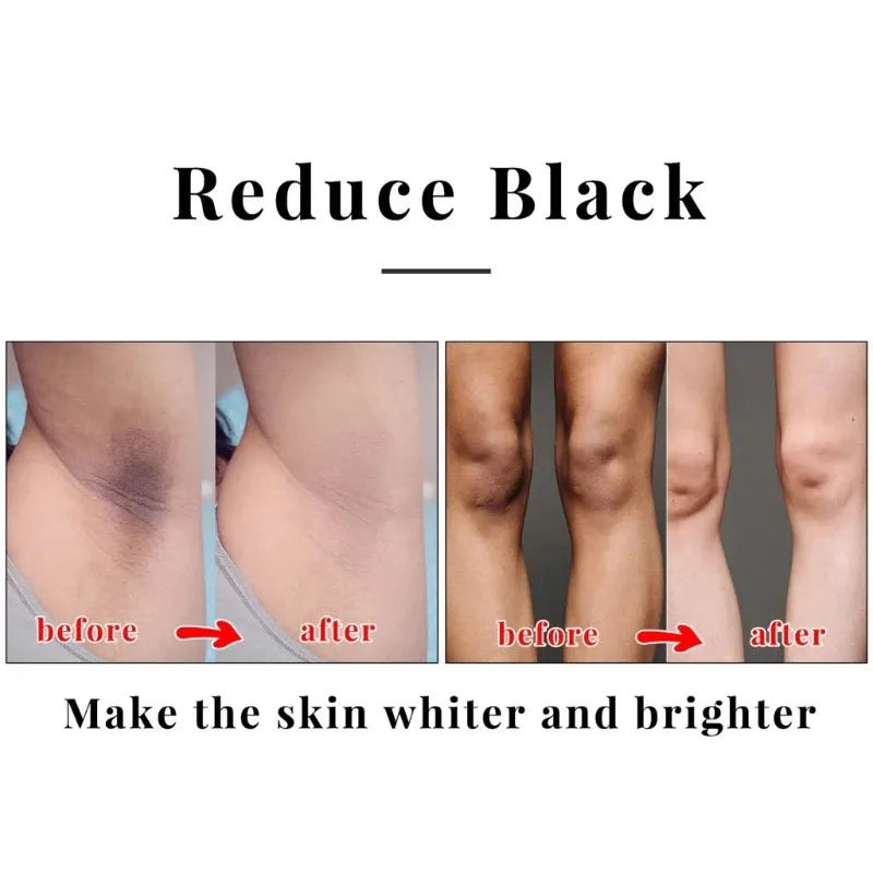 E5XZ 2Pieces Kojic Acid Face Body Bath Soap Safe Natural Soap for Men Women Glowing Hydrated Blackheads Removal Makeup Soap