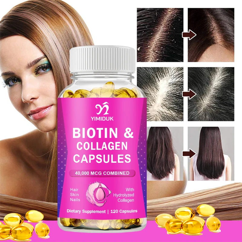 Biotin Capsules | Collagen | Keratin | Hyaluronic Acid - Hair Growth Support Supplement | Skin & Nails Beauty Complex
