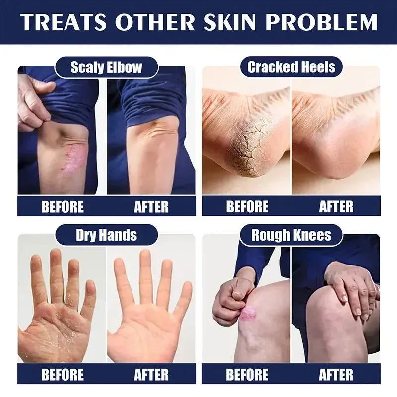 30g Anti Crack Foot Hand Cream Anti-Drying Heel Cracked Repair Hand Feet Mask Moisturizing Whitening Remover Dead Skin Feet Care