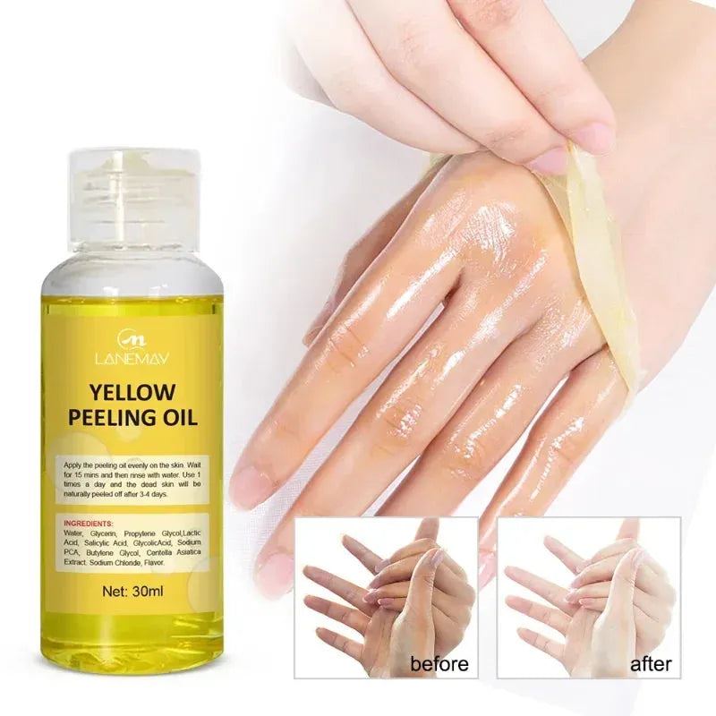 Body Care Exfoliating Yellow Peeling Oil 100% Organic Bleaching Dark Skin Serum Dark Kniten Exfoliating Dead Skin Care Serum New