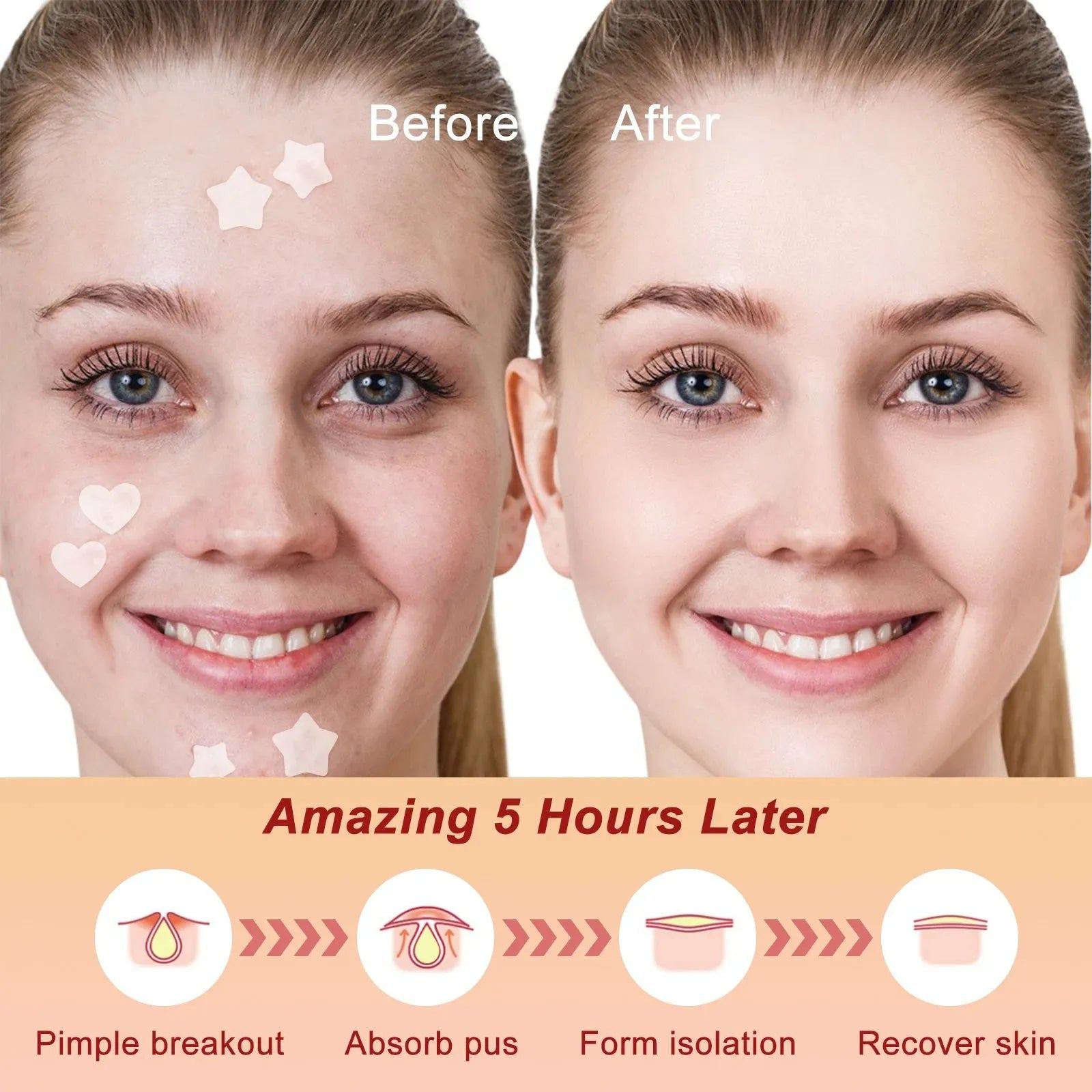 168pcs Patches Acne Patch Acne Pimple Patch Stickers Day Night Use Hydrocolloid Blackhead Blemish Removers Beauty Face Skin Care