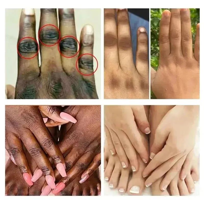 2024 Dark Knuckles Fast Whitening Serum Anti Cracking Cream Pigmentation Correctors For Black Skin Fast Stains Remover Products