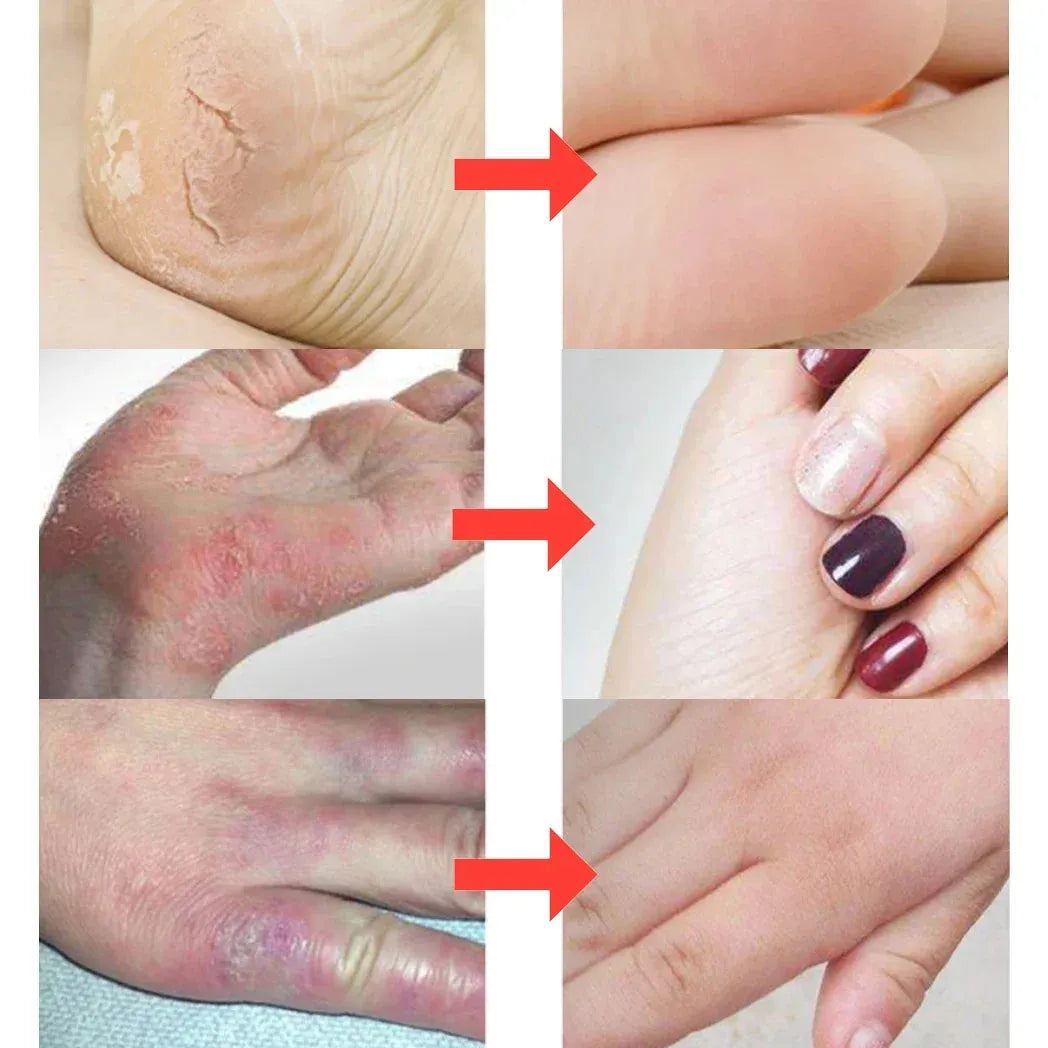 Traditional Chinese Clam Oil Cracked Repair Cream Anti-Drying Removal Dead Skin Hand Feet Foot Moisturize Care Oil Care Ointment
