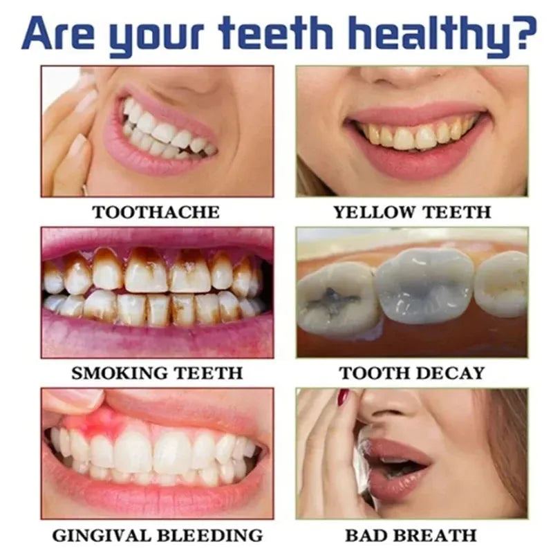 Tooth Whitening Enzyme Purple Mousse Remove Plaque Cleaning Oral Hygiene Dental Bleaching Tools Fresh Breath Beauty Tooth Care