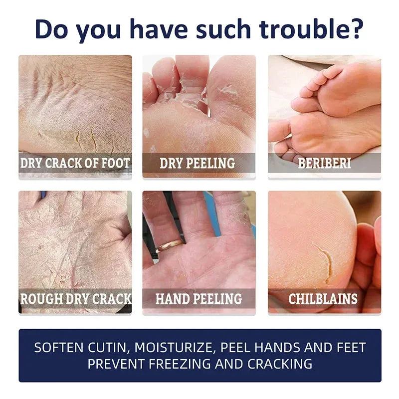30g Anti Crack Foot Hand Cream Anti-Drying Heel Cracked Repair Hand Feet Mask Moisturizing Whitening Remover Dead Skin Feet Care