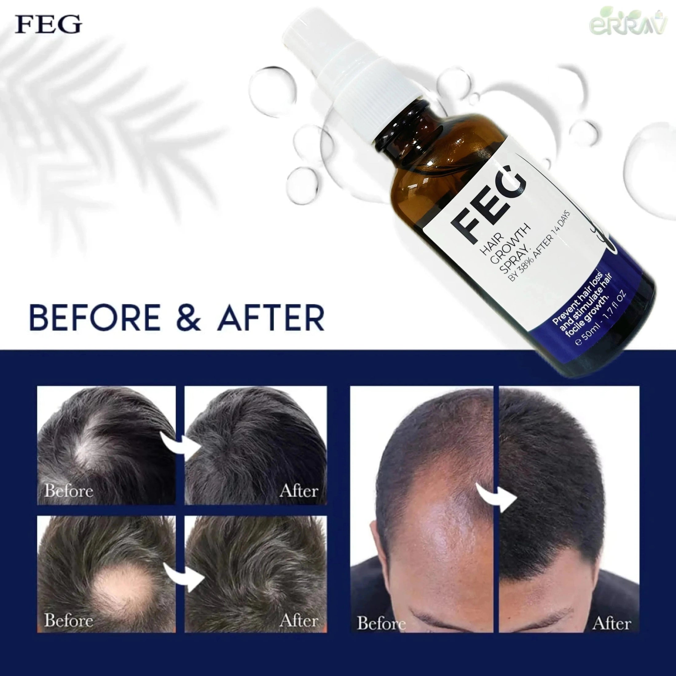 FEG hair growth spray hair loss HAIR GROWTH stimulate hair focile growth ownning Longer, thicker and healthier hair