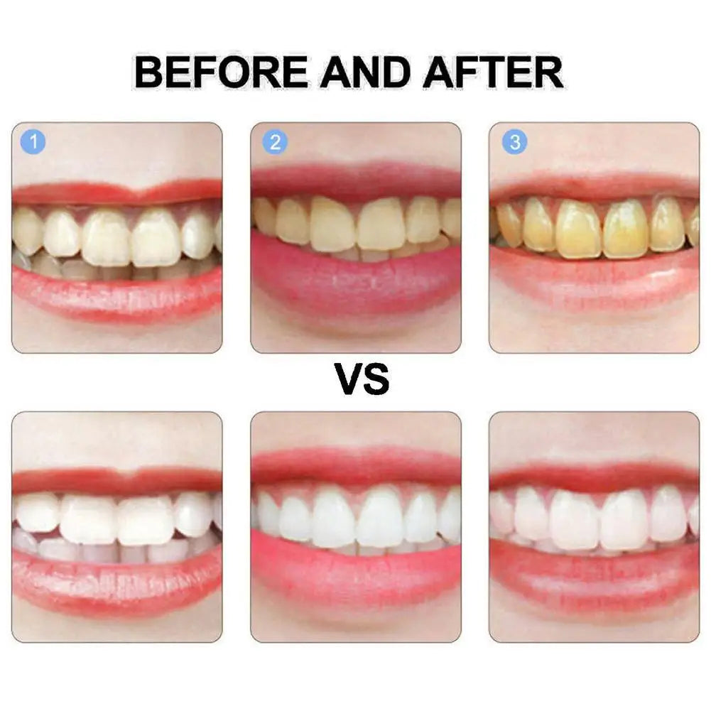 Probiotic Whitening Toothpaste Oral Health Breath Freshener Tteeth Cleaning Brightening Stains Calculus Remover Teeth care