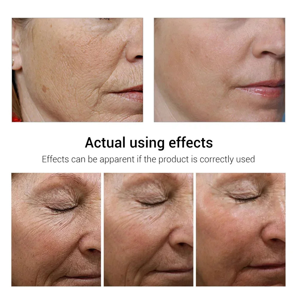 Retinol Wrinkle Remover Face Set Instant Firming Lifting Anti-aging Serum Fade Fine Lines Whitening Korean Skin Care Products