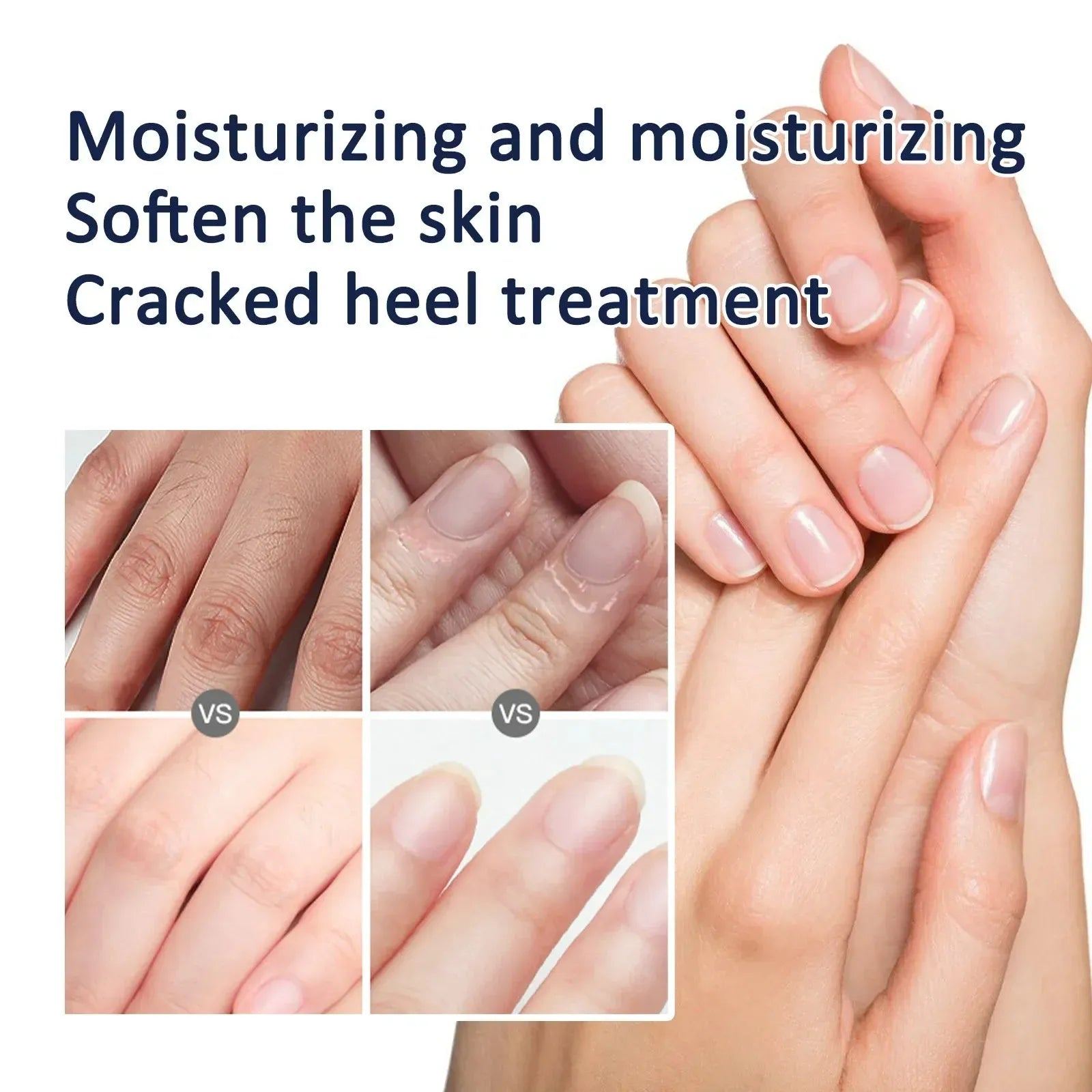 Traditional Chinese Clam Oil Cracked Repair Cream Anti-Drying Removal Dead Skin Hand Feet Foot Moisturize Care Oil Care Ointment