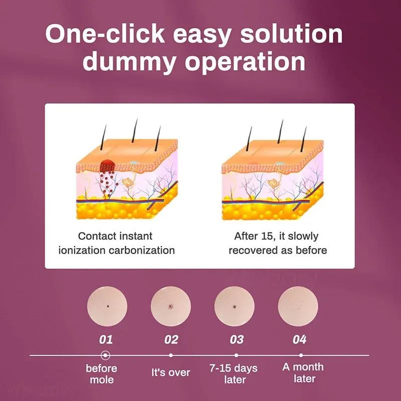 LCD Laser Plasma Pen Skin Tag Remover Kit Freckle Black Dot Papilloma Warts Mole Pimples Tattoo Remaval Beauty Care Tool Device