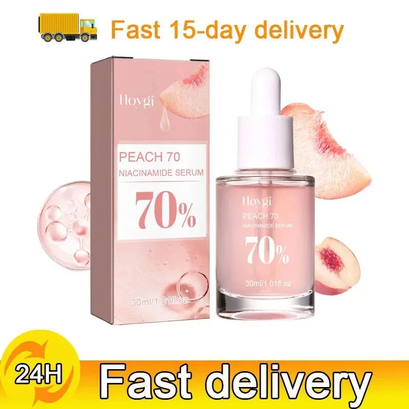 Niacinamide Dark Spots Remover Serum Face Freckle Melanin Correcting Essence Anti Pigmentation Whitening Brighten Dull Skin Care