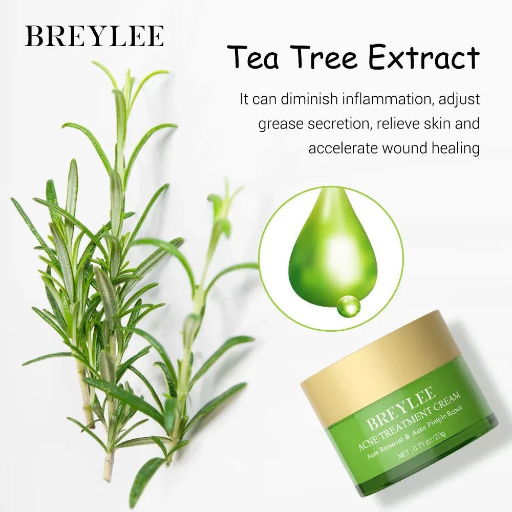 BREYLEE 20g Acne Treatment Cream Anti Acne Face Cream Pimple Removal Spots Oil Control Shrink Pores Moisturizing Skin Care Serum
