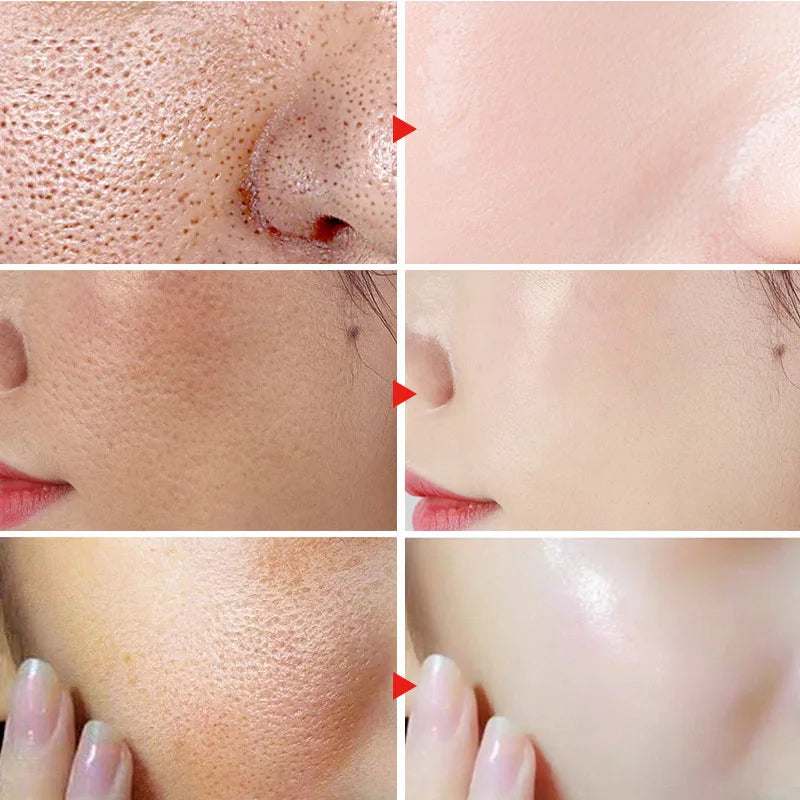 Lactic Acid Large Pores Removal Serum Fast Pore Shrinking Minimizing Essence Moisturizing Firming Smooth Repair Korean Skin Care