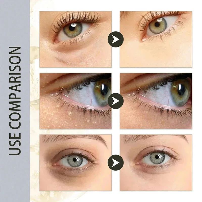 Fat Granules Removal Eye Cream Stick Anti Puffiness Firming Cream Antiaging Fade Fine Line Inflammatory Repair Barrier Skin Care