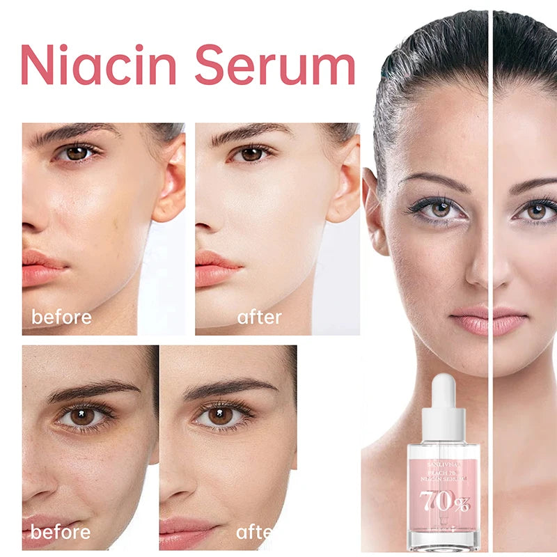 Korean Facial Serum Niacinamide Brighten Skin Rejuvenating Hydrating Whitening Lotion Fade Melasma Fine Lines Skin Care Essence