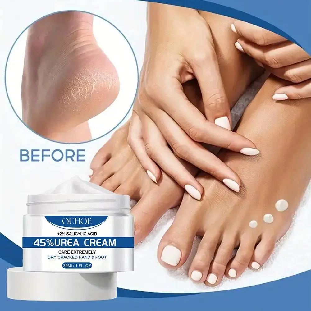 Anti-dry Foot Cream 42% Urea Repairing Cream Foot & Leg Anti-Cracking ,Deep Soothing Moisturizing Heel Treatment Foot Care Cream