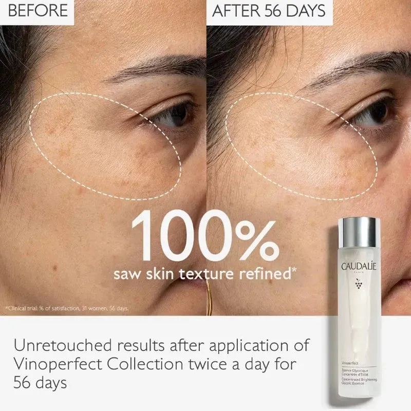 Vinoperfect Concentrated Brightening Glycolic Essence Whitening Moisturizing Toner Vinoperfect Essence and Serum Duo Women