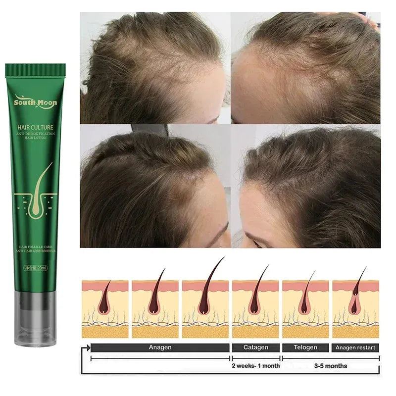 Fast Hair Growth Essence Hair Regeneration Essence Hair Follicle Care Anti-Hair Loss Essence Hair Thin Treatment Hair Care