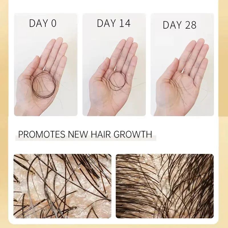 Biotin Hair Growth Shampoo Conditioner Set Anti Hair Loss Treatment for Men Women Fast Thicken Regrowth Oil Beauty Health PURC