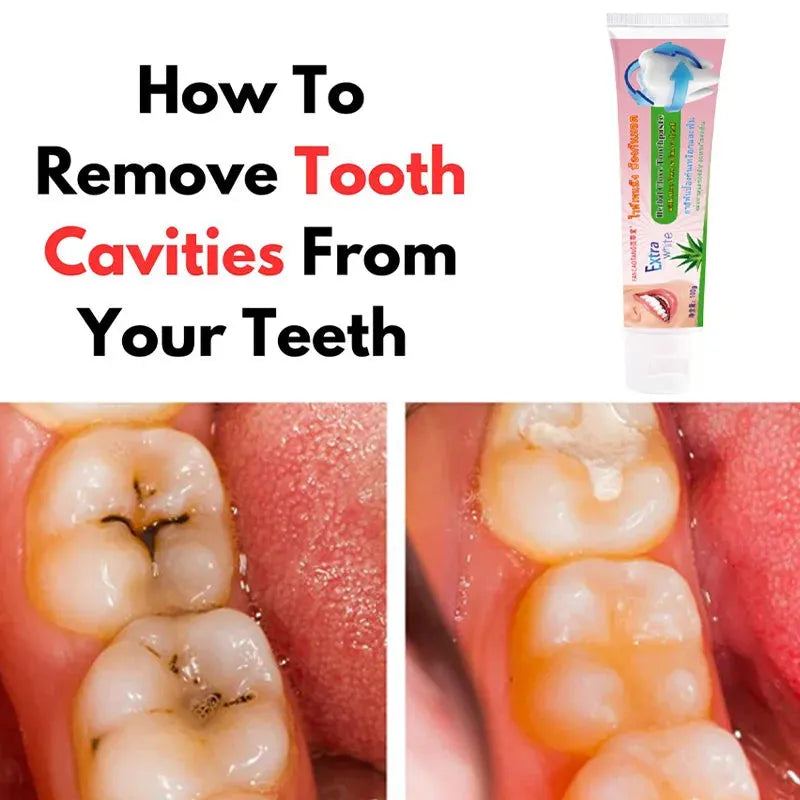 Thai Toothpaste Whitening Teeth Fresh Breath Suitable For Removing Tartar Yellow Teeth Bright White To Get Rid Of Bad Breath