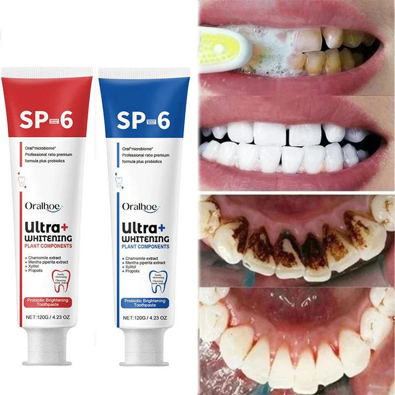 Sp-6 Probiotic Whitening Toothpaste Oral Health Breath Freshener Tteeth Cleaning Brightening Stains Calculus Remover Anti Yellow
