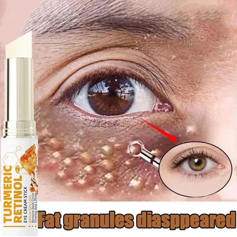 Fat Granules Removal Eye Cream Stick Anti Puffiness Firming Cream Antiaging Fade Fine Line Inflammatory Repair Barrier Skin Care