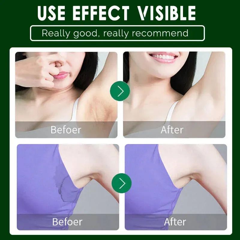 Powerful Body Odor Underarm Care Bleaching Cream Man Women Effectively Remove Odor Refreshing Lasting Aroma Cream Body Care