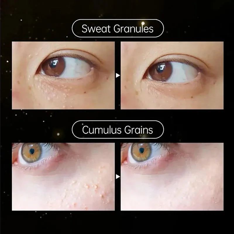 Fat Granules Removal Eye Cream Stick Anti Puffiness Firming Cream Antiaging Fade Fine Line Inflammatory Repair Barrier Skin Care