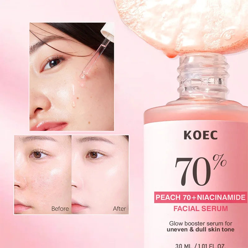 Korean Facial Serum Niacinamide Brighten Skin Rejuvenating Hydrating Whitening Lotion Fade Melasma Fine Lines Skin Care Essence