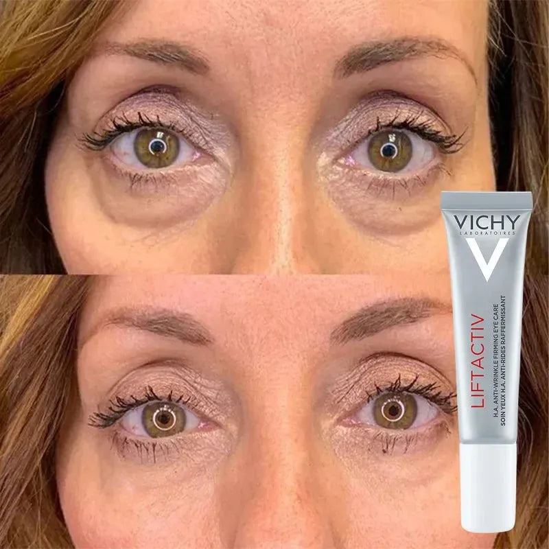 15ml Peptide Collagen Eye Cream Retinol Essence Anti-Dark Circles Remove Fat Particles Firming Lifting Eye Skin Beauty Eyecare
