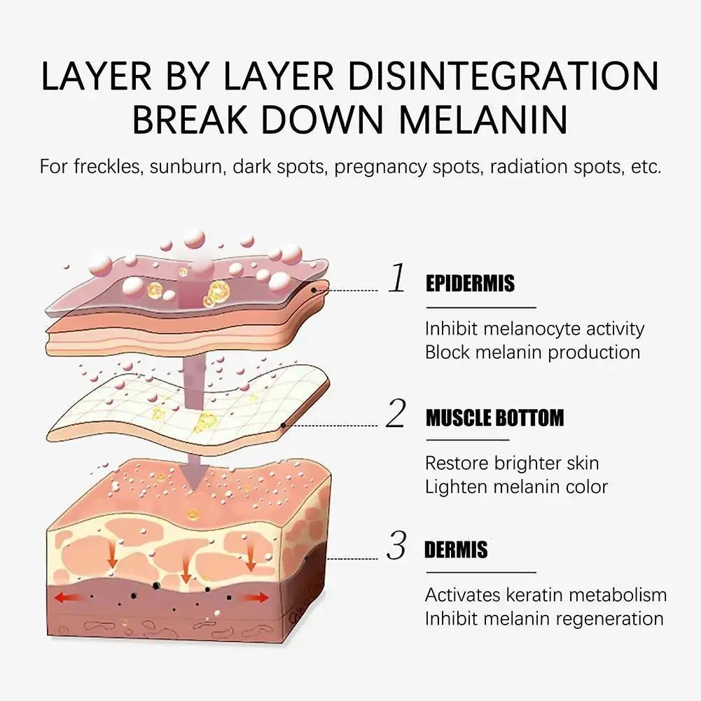 Dark Spot Remover Skin Color Corrector Cream Face & Body Serum Age Spot Sun Spot Freckles Melasma Brown Spot for Women and Men