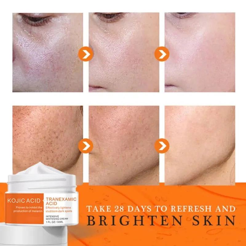 30ml Intensive Whitening Day Creams Moisturizers Acid Tranexamic Acid Inhibit Melanin Lightens Stubborn Dark Spots