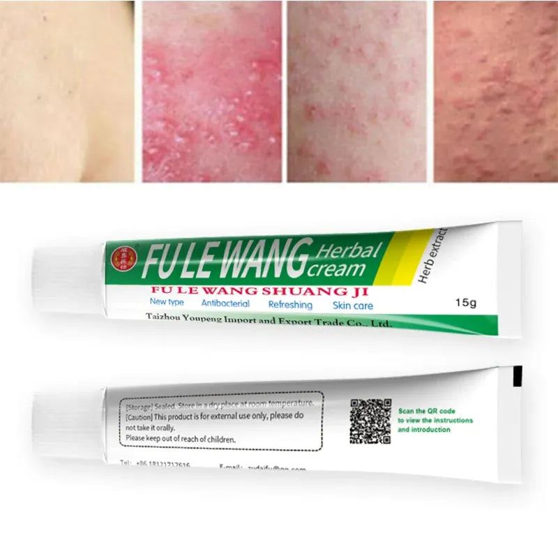 1PCS fulewang Eczema Ointment Treatment Psoriasis Cream  Herbal Psoriasis Pruritus Cream Dermatitis Eczematoid Skin Care Cream