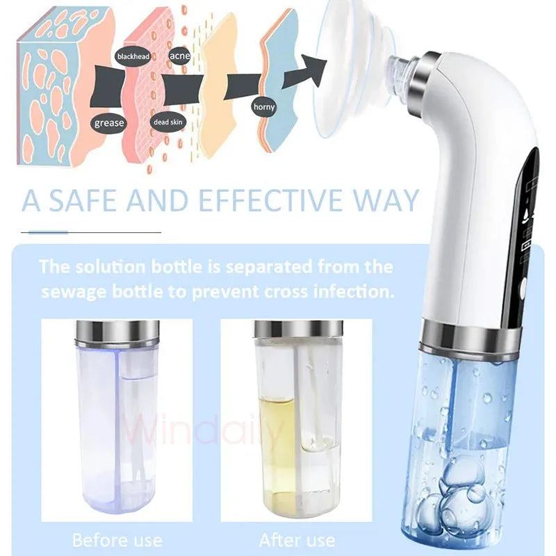 Electric Facial Blackhead Remover Vacuum Pore Cleaner Acne Cleanser Black Spots Removal Face Nose Deep Cleaning tools