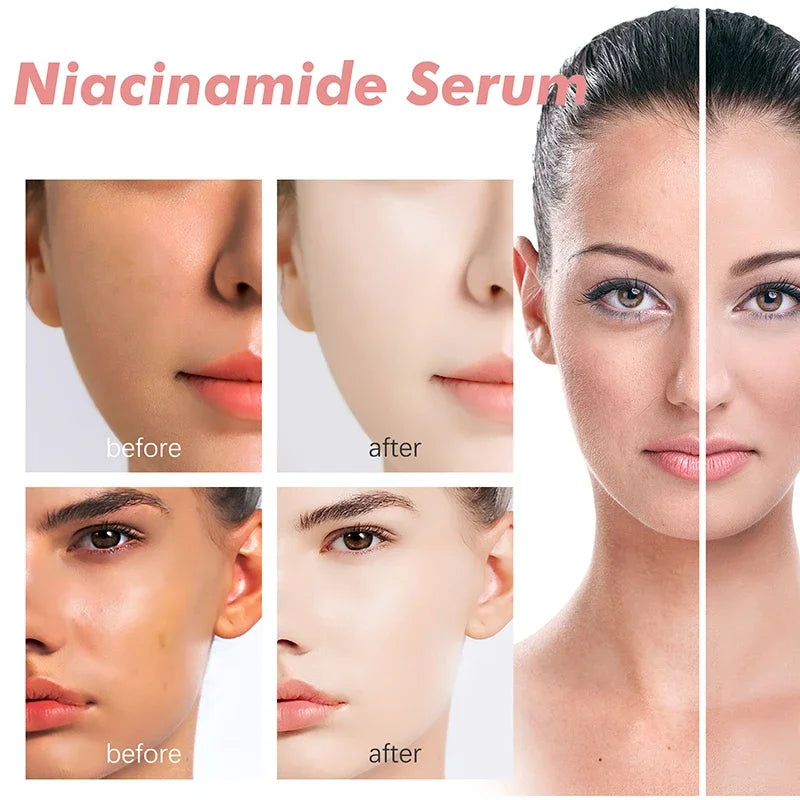 Peach 70% Niacinamide Serum Moisturizing Prevent Dryness Facial Essential Oil Increasing Elasticity Smooth Soften Skin Care 30ml