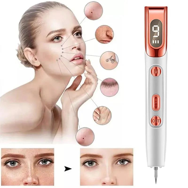 LCD Plasma Pen Profesional Laser Tattoo Mole Removal Pen Skin Care Tools Tag Removal Freckle Wart Dark Spot Remover Beauty Care