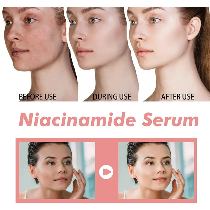 Peach 70% Niacinamide Serum Moisturizing Prevent Dryness Facial Essential Oil Increasing Elasticity Smooth Soften Skin Care 30ml