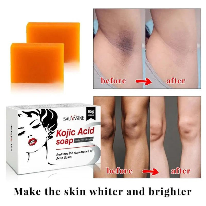 E5XZ 2Pieces Kojic Acid Face Body Bath Soap Safe Natural Soap for Men Women Glowing Hydrated Blackheads Removal Makeup Soap