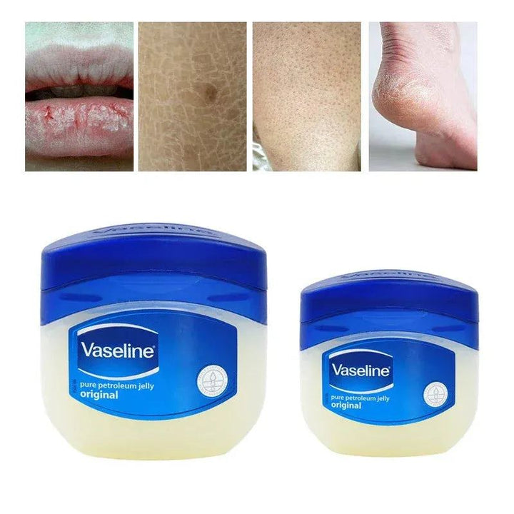 7/50/100g Vaseline Lip Balm Deep Hydrating Long Lasting Moisturizing Anti-cracking Cream For Hand Foot Heel Anti Dry Lip Mask