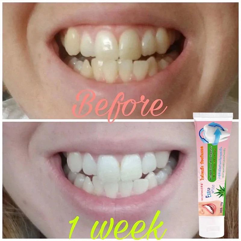 Thai Toothpaste Whitening Teeth Fresh Breath Suitable For Removing Tartar Yellow Teeth Bright White To Get Rid Of Bad Breath