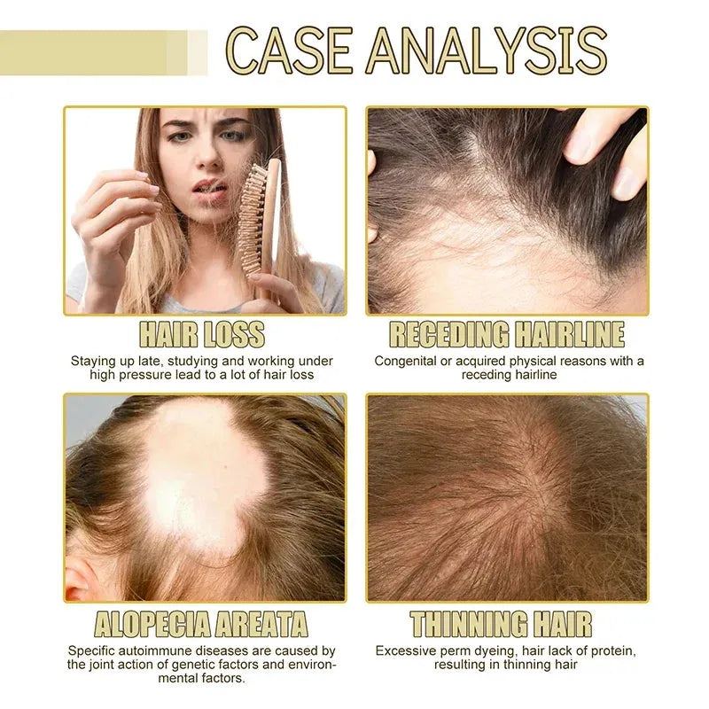 EELHOE Dense Hair Essential Oil Softens Nourishes Hair Repairs Hair Damage Prevents Hair Loss And Nourishes Hair Essence Oil New